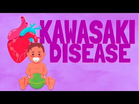 Kawasaki Disease PEDIATRICS
