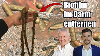 Download the video "Biofilm im Darm ausscheiden mit der Darm-Detox-Kur | Erfahrungen | Uwe Karstädt & Sören Schumann"