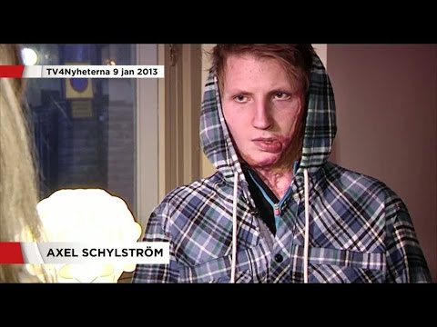 Se Axel Schylströms väg från olyckan till Idol-succén - Nyheterna (TV4)