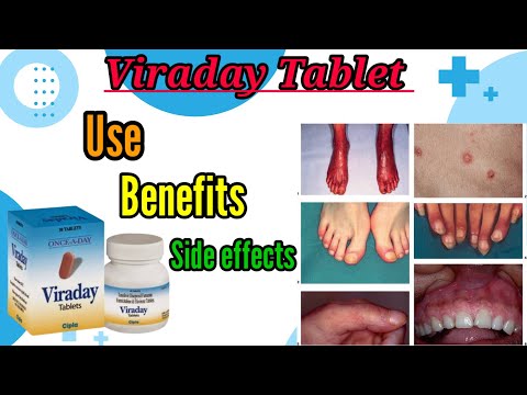 Viraday Tablets Cipla