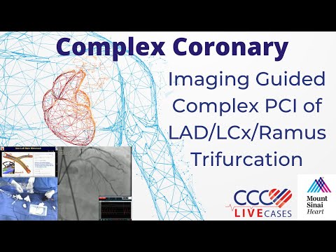 Imaging Guided Complex PCI of LAD/LCx/Ramus Trifurcation - Feb 2023