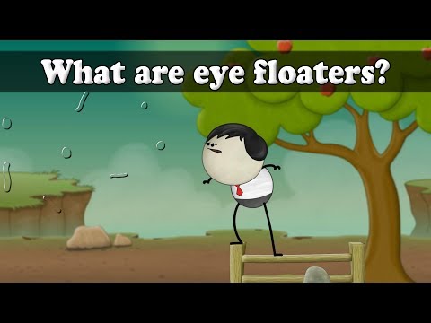 アイフローターとは?| 目の浮腫みについて|#aumsum (What are eye floaters? | #aumsum)
