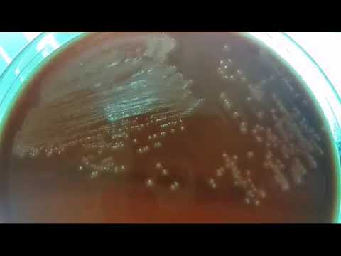 Streptococcus agalactiae????