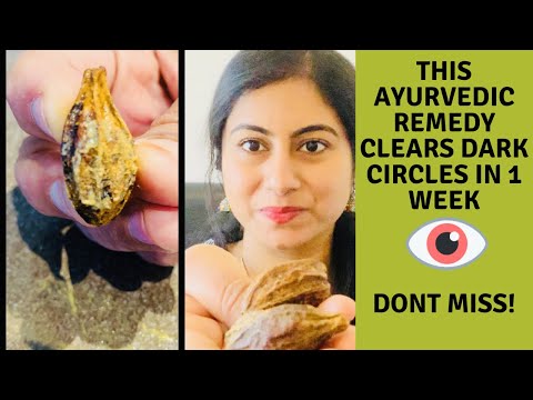 Clear dark circles permanently in 1 week/ ayurvedic remedy