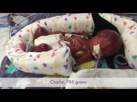 The Gardner Story - Baby Charlie | Born at 25 Weeks