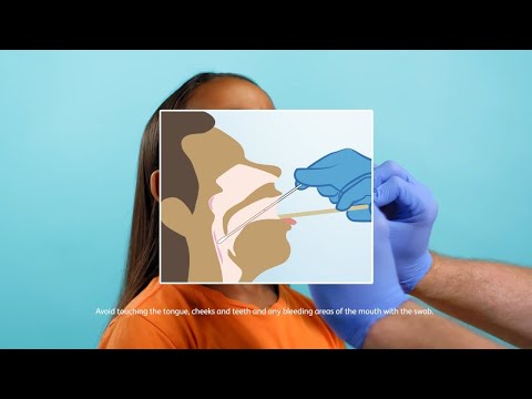 Rapid Group A Strep Testing