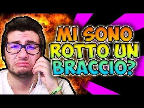 MI SONO ROTTO UN BRACCIO? - #MarcyFaq