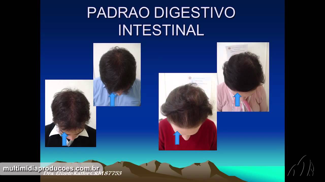 Dra. Elizete Kaffer -   Tricologia Biodinâmica