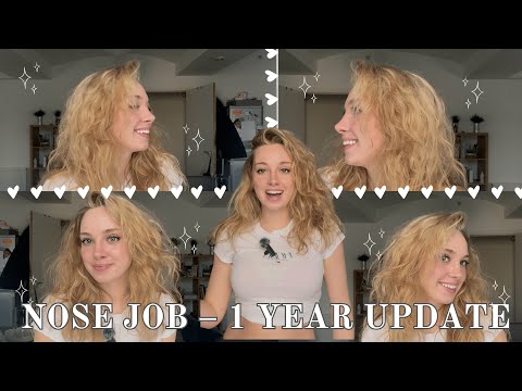 I Got a NOSE JOB – 1 YEAR UPDATE! 💉👃✨