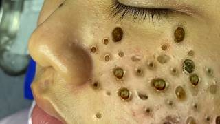 𝐑𝐞𝐟𝐫𝐞𝐬𝐡 𝐘𝐨𝐮𝐫 𝐅𝐚𝐜𝐞 𝐖𝐢𝐭𝐡 LNG 𝐒𝐤𝐢𝐧 𝐂𝐚𝐫𝐞 #