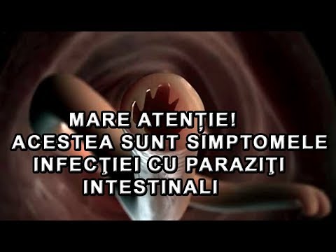 giardia tratament naturist viermi cum sunt numiți