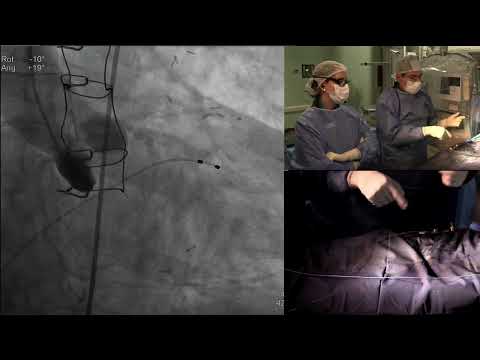 LIVE CASE “VitaFlow” FROM “SANATORIO FINOCHIETTO” BA, ARGENTINA - SOLACI-SOCIME 2022