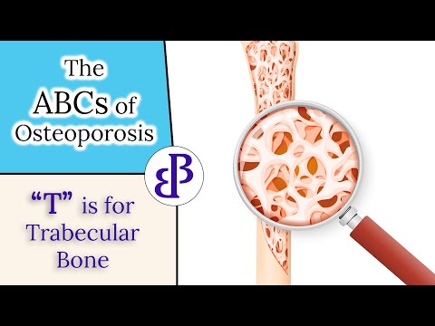 T is for Trabecular Bone - The ABCs of Osteoporosis