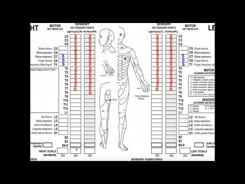 Classifying Spinal Cord Injuries using ASIA Scoring [Example 2]