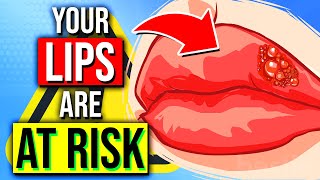 Your LIPS Are Giving You These 12 Health Warnings! - Are You At Risk?