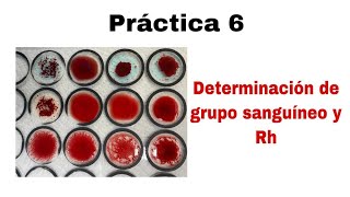 Práctica 6  Determinación de grupo sanguíneo y Rh