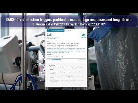 COVID-19 Virus induzierte Lungenfibrose erklärt lange Beatmungszeiten