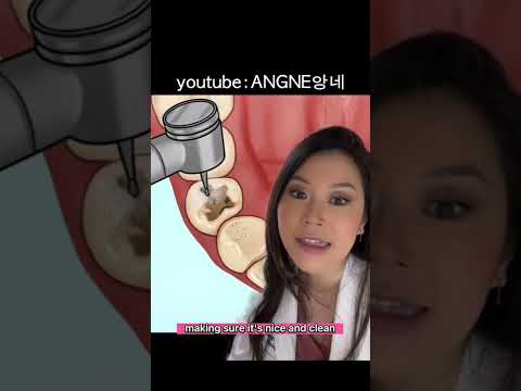 Steps the dentist takes to fill YOUR cavity. #cavity #dentist #filling