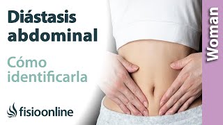 Cómo SABER si tengo DIÁSTASIS ABDOMINAL tras el embarazo y parto