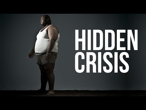 Thiamine Deficiency: The Hidden Epidemic Affecting Obesity and Diabetes