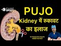 PUJO - Kidney में रुकावट का इलाज | Pyeloplasty Treatment in Hindi- Dr. Deepanshu Gupta #ki