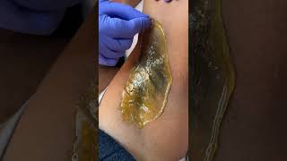 Satisfying underarm waxing using hard wax