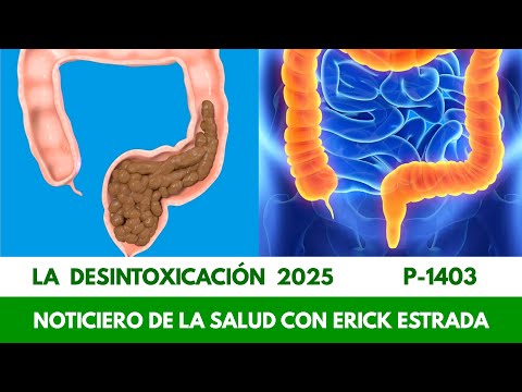 P-1403 La Desintoxicación 2025