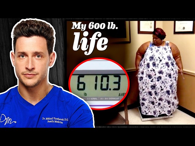 The Brutal Reality of Life At 600+ Pounds SDDEFAULT Thumbnail