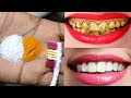 How Did I Whiten My Teeth At Home In 3 Days Teeth Whitening Tips