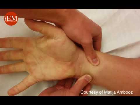 623   Modified Allen Test