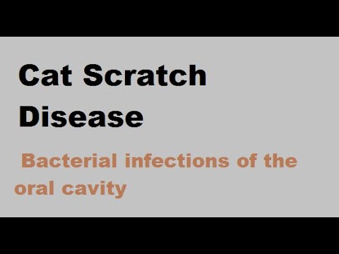 Cat scratch disease : Bacterial infections of the oral cavity