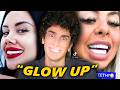 The Veneer Epidemic Nobody’s Talking About DEFAULT Thumbnail