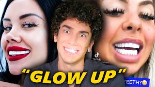 The Veneer Epidemic Nobody’s Talking About MQDEFAULT Thumbnail