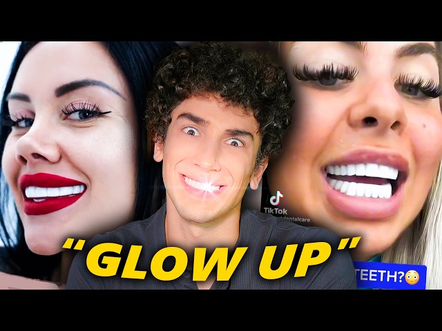 The Veneer Epidemic Nobody’s Talking About SDDEFAULT Thumbnail