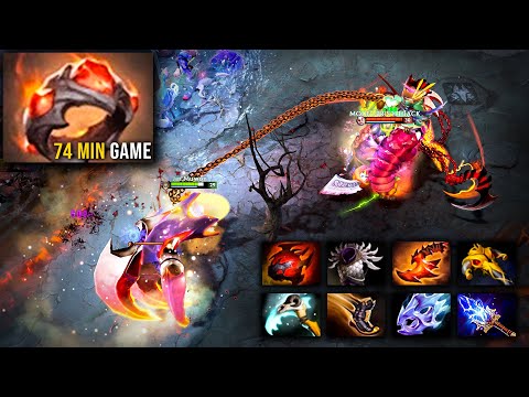 Giant's Ring On Pudge Is Always SATISFYING 🔥🔥🔥 | Pudge Official