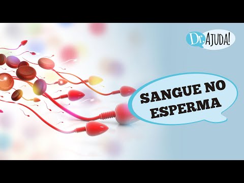 Blood in semen: causes, diagnosis, and treatment.