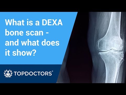 What is a DEXA bone scan and what does it show?
