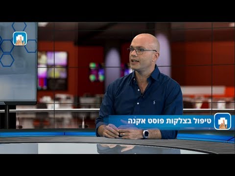 טיפול בצלקות פוסט אקנה: המילון הרפואי