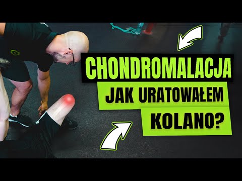 CHONDROMALACJA RZEPKI I KŁYKCI PISZCZELOWYCH- moja historia