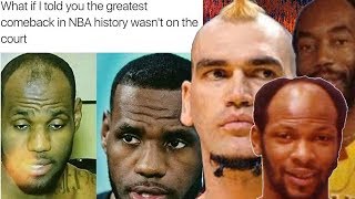 Top 10 WORST HAIRLINES in NBA HISTORY! (LeBron's Dad!!!)