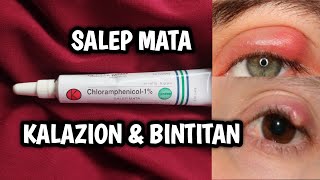 Download lagu Salep mata bintitan dan kalazion dengan #chloramphenicol -1% mp3 Download lagu Salep mata bintitan dan kalazion dengan #chloramphenicol -1% mp3