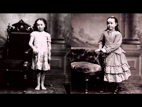 Mary Ellen Wilson: The First Case of Child Abuse Intervention