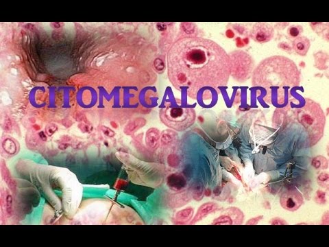 HPV védőoltás | Vajda Miklós