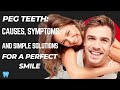 Peg Teeth: Causes, Symptoms, and Simple Solutions for a Perfect Smile