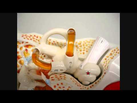 First Successful Installations of Vestibular Implants in Humans    - Sep 26th 2012 -