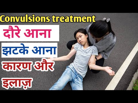 Seizures, convulsions treatment || causes, symptoms || medicines || #medishanmedicos