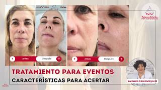 Protocolos de Evento: Claves para Tener Éxito en Tratamientos Exprés ? con Yolanda Pérez Mayoral