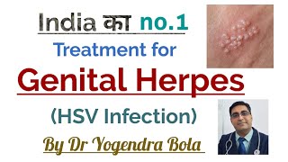 Genital Herpes [ HSV INFECTION ] - Ka  complete 100 %  Treatment