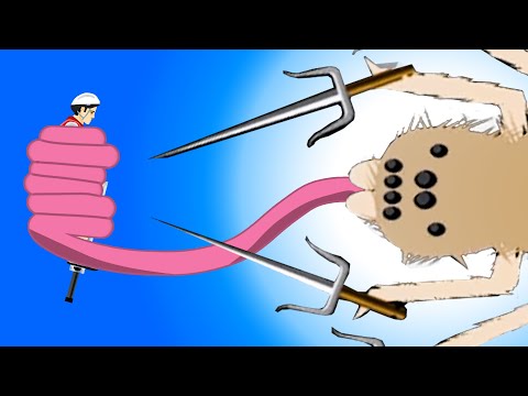 When phobias get 1000x worse