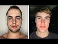 I M An Average Looking Guy That Tried Looksmaxxing 30 Day Update